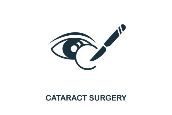 Cataract Surgery Icon: A Versatile Visual Tool for Ophthalmology Content